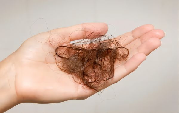 How Much Hair Loss Is Normal？Fun Facts To Know